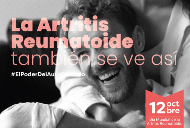 BLOG–SE-VE-ASÍ artritis reumatoide - artritis-enfermedad cronica articular- articulaciones - inflamaci{on en las articulaciones