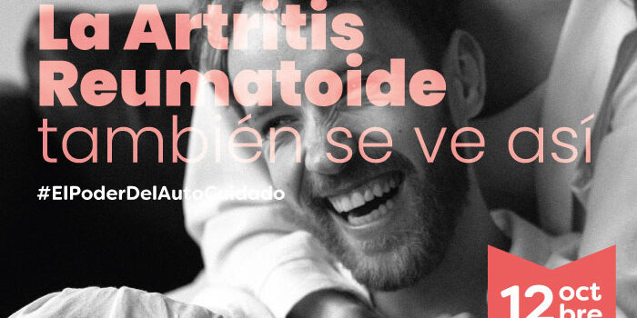 artritis reumatoide - artritis-enfermedad cronica articular- articulaciones - inflamaci{on en las articulaciones